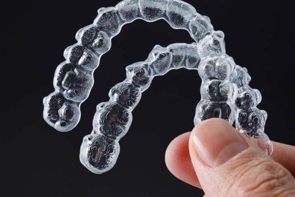 Orthodontic Retainers Wilsonville Orthodontics in Wilsonville, OR